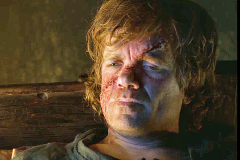 Manchester United Part V/Ole Sack Watch - Page 35 Tyrion-hurt
